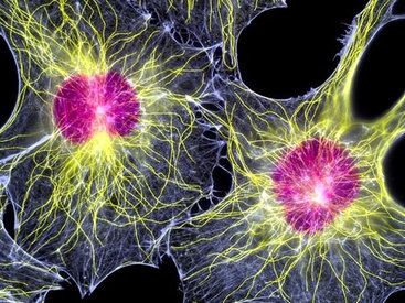 Президент Армении решил избавиться от морщин