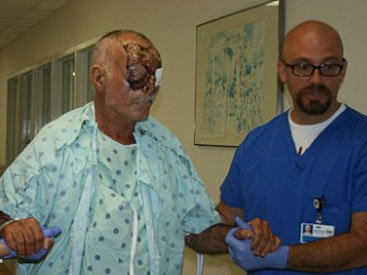 ШОК! Врачи показали американца, лицо которого съел каннибал - ФОТО