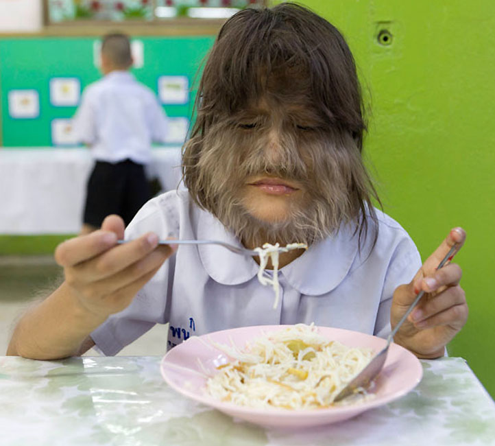 Книга Рекордов Гиннеса "засекла" самую волосатую девочку в мире - ОБНОВЛЕНО - ФОТО