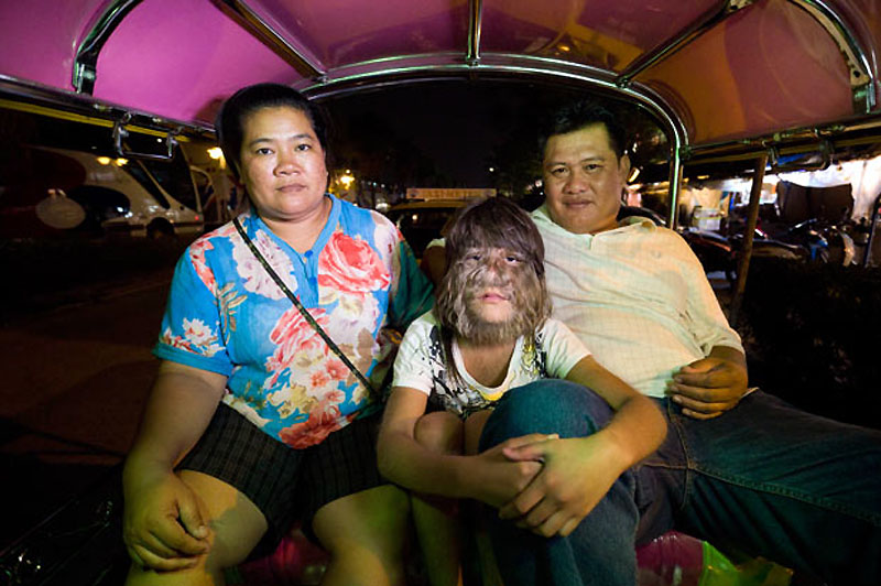 Книга Рекордов Гиннеса "засекла" самую волосатую девочку в мире - ОБНОВЛЕНО - ФОТО