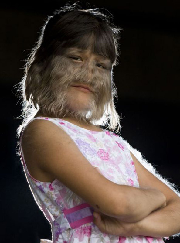 Книга Рекордов Гиннеса "засекла" самую волосатую девочку в мире - ОБНОВЛЕНО - ФОТО