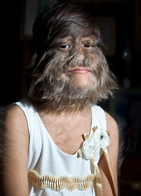 Книга Рекордов Гиннеса "засекла" самую волосатую девочку в мире - ОБНОВЛЕНО - ФОТО