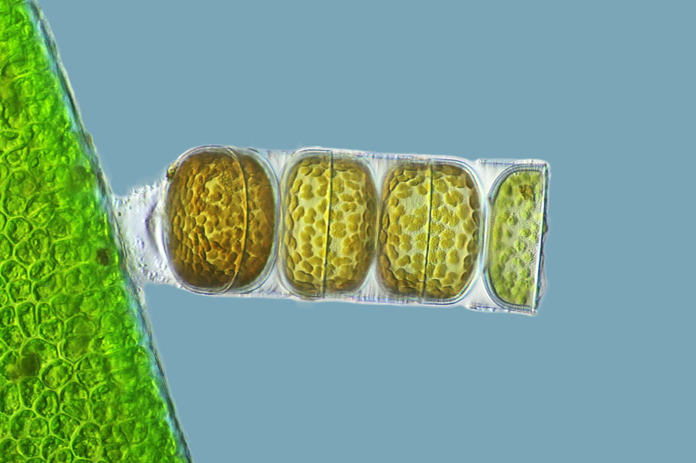 Неизведанный мир: конкурс микрофотографии Nikon Small World 2011 - ФОТОСЕССИЯ