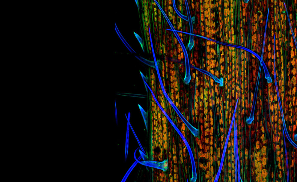 Неизведанный мир: конкурс микрофотографии Nikon Small World 2011 - ФОТОСЕССИЯ