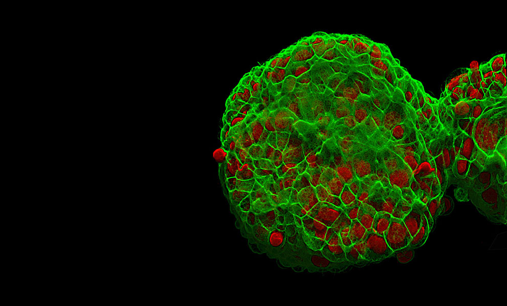 Неизведанный мир: конкурс микрофотографии Nikon Small World 2011 - ФОТОСЕССИЯ