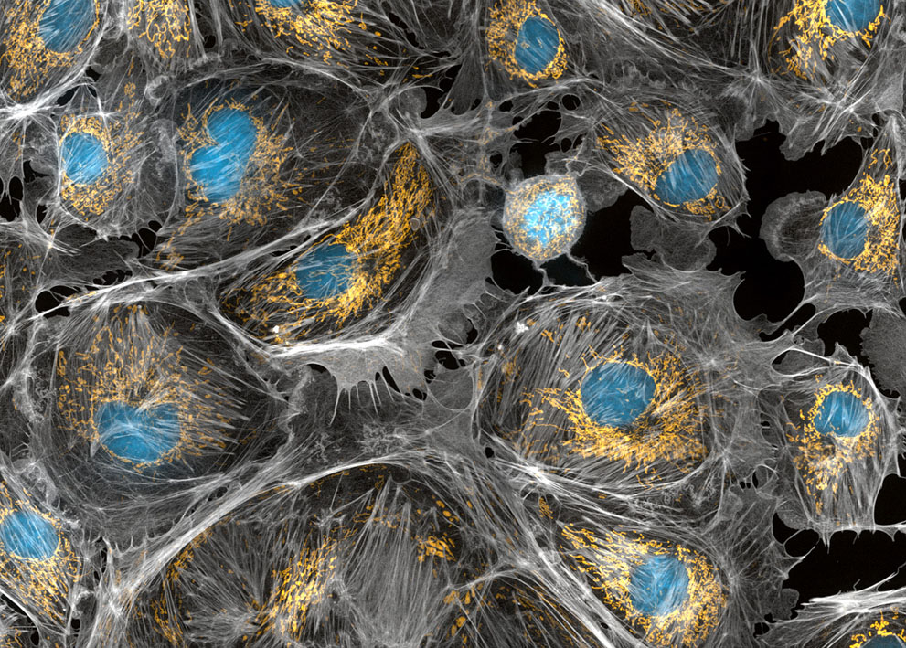 Неизведанный мир: конкурс микрофотографии Nikon Small World 2011 - ФОТОСЕССИЯ