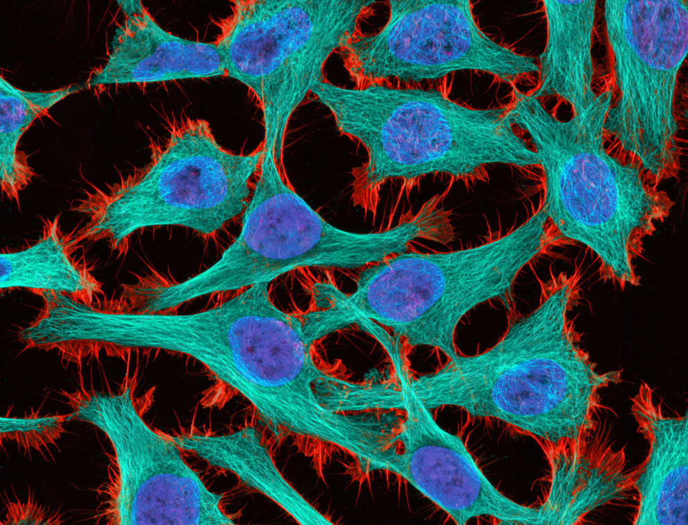 Неизведанный мир: конкурс микрофотографии Nikon Small World 2011 - ФОТОСЕССИЯ