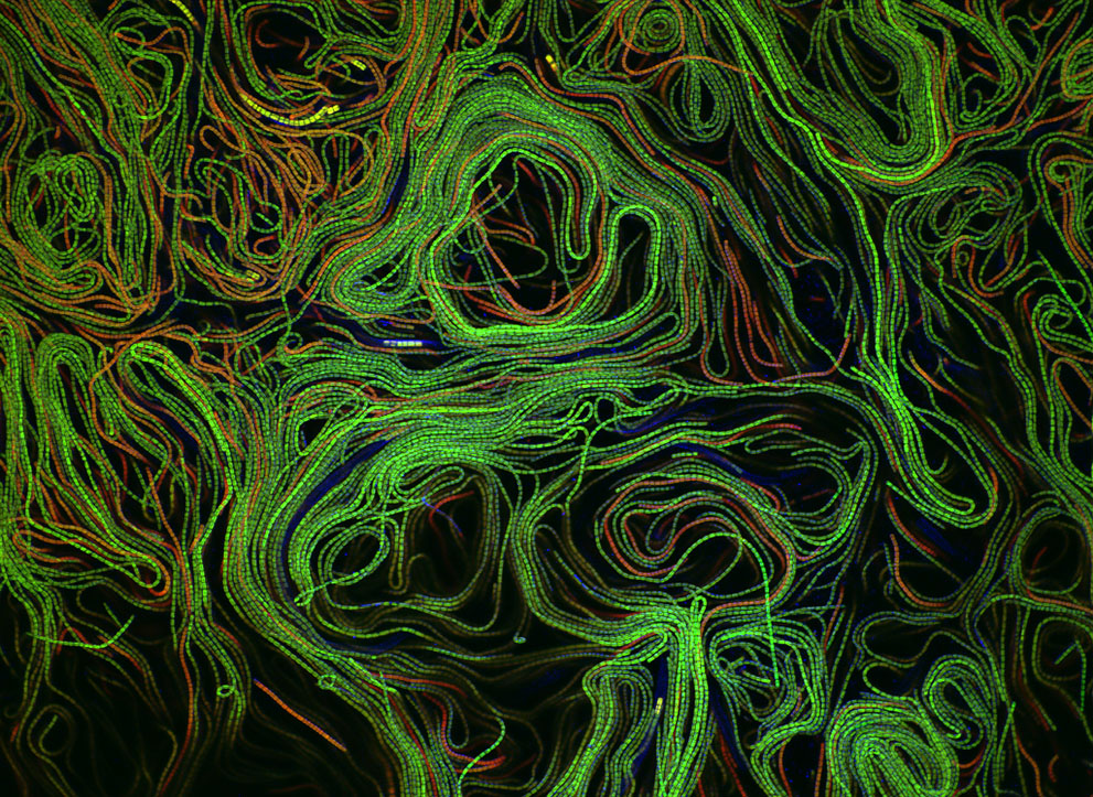Неизведанный мир: конкурс микрофотографии Nikon Small World 2011 - ФОТОСЕССИЯ