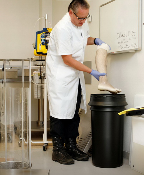 Мужчина выставил на продажу на eBay собственную ногу - ФОТО