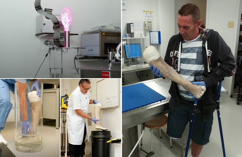 Мужчина выставил на продажу на eBay собственную ногу - ФОТО