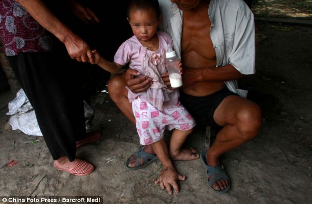 У китайской девочки ноги растут в несколько раз быстрее остального тела - ФОТО