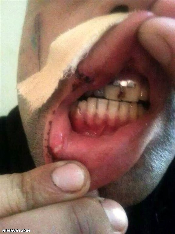"Oazis" davasından yeni şok xəbərlər - FOTO