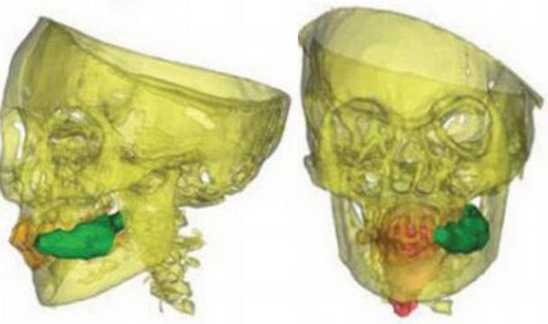 Ученые раскрыли тайну 500-летней девочки-мумии - ФОТО