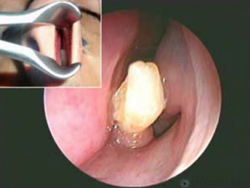 10 невероятно странных фактов о человеческих зубах - ФОТО