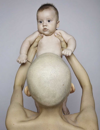 Невероятные фотографии модели, потерявшей челюсть из-за рака - ФОТО