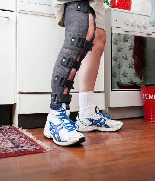 Мужчина выставил на продажу на eBay собственную ногу - ФОТО