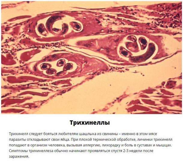 Паразиты, которых следует опасаться летом - ФОТО