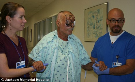 ШОК! Врачи показали американца, лицо которого съел каннибал - ФОТО