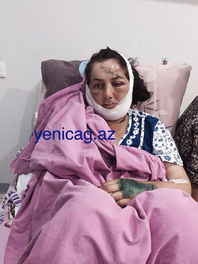 Yol polisinin səbəb olduğu və ölümlə nəticələnən qəzadan sensasiyalı faktlar - FOTO