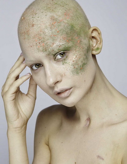 Невероятные фотографии модели, потерявшей челюсть из-за рака - ФОТО