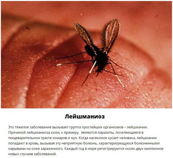 Паразиты, которых следует опасаться летом - ФОТО