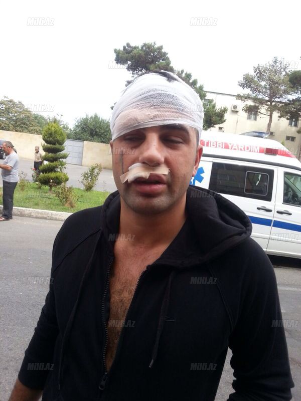 "Oazis"dəki dəhşətli dava anbaan - YENİLƏNİB - VİDEO - FOTO