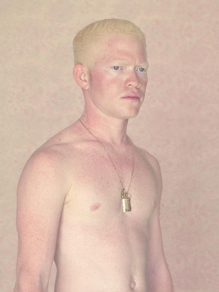 Не такие как все: люди-альбиносы - ФОТОСЕССИЯ