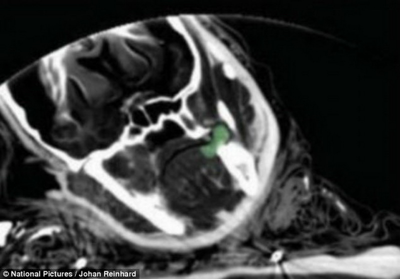 Ученые раскрыли тайну 500-летней девочки-мумии - ФОТО