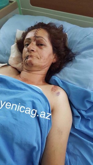 Yol polisinin səbəb olduğu və ölümlə nəticələnən qəzadan sensasiyalı faktlar - FOTO