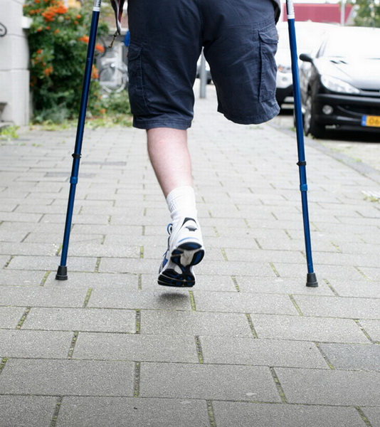 Мужчина выставил на продажу на eBay собственную ногу - ФОТО