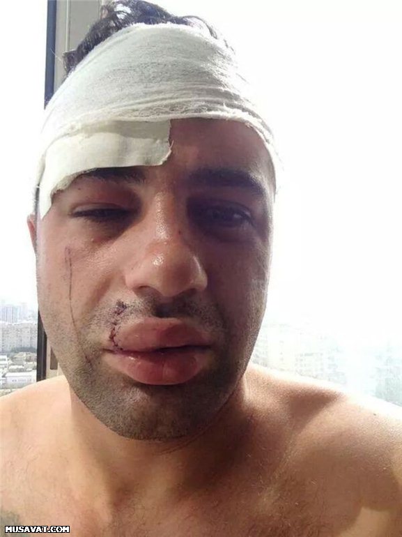 "Oazis" davasından yeni şok xəbərlər - FOTO