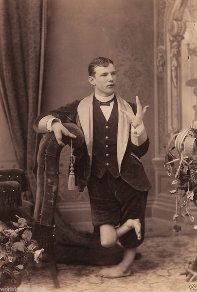 Винтажные фотографии цирковых артистов, на которые больно смотреть - ФОТОСЕССИЯ