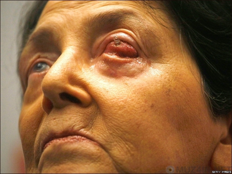 10 невероятно странных фактов о человеческих зубах - ФОТО