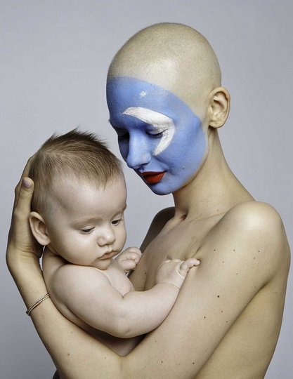 Невероятные фотографии модели, потерявшей челюсть из-за рака - ФОТО