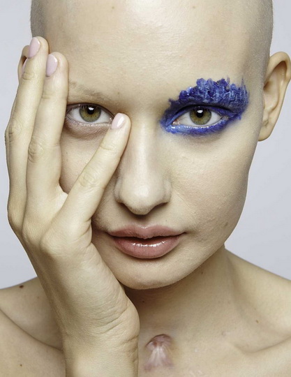 Невероятные фотографии модели, потерявшей челюсть из-за рака - ФОТО