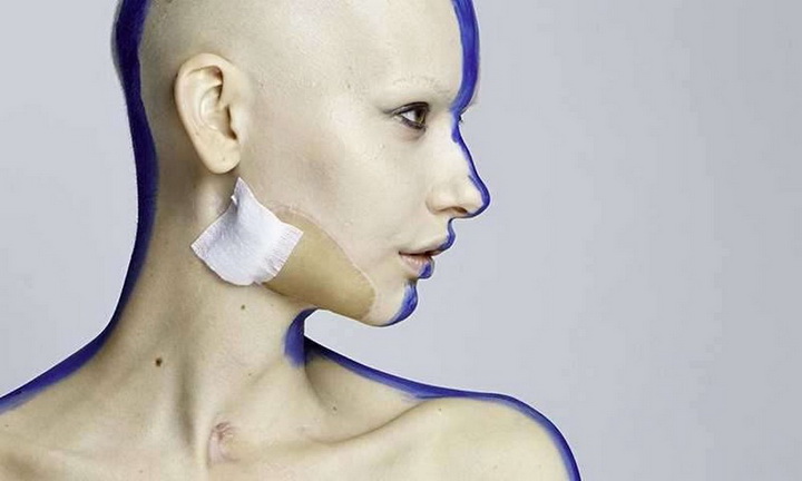 Невероятные фотографии модели, потерявшей челюсть из-за рака - ФОТО