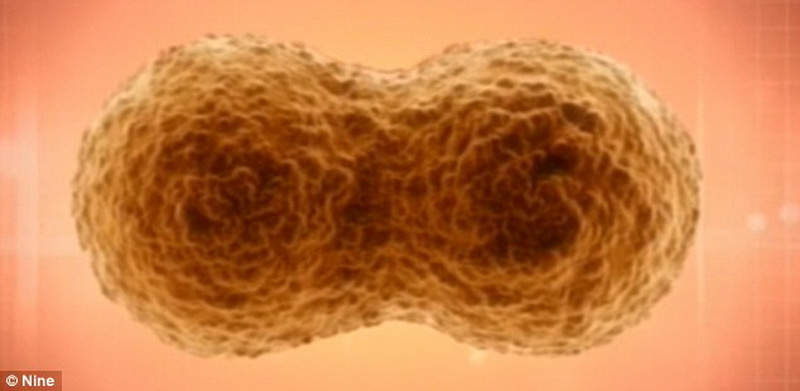 Женщина готовится родить двухголового ребенка - ФОТО