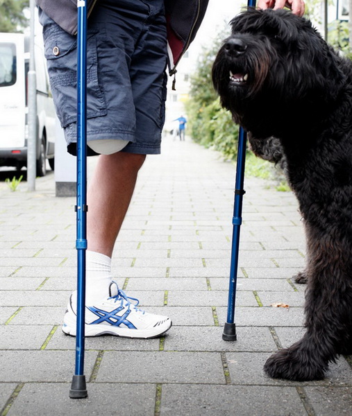 Мужчина выставил на продажу на eBay собственную ногу - ФОТО