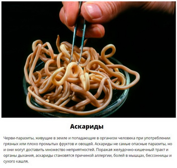 Паразиты, которых следует опасаться летом - ФОТО