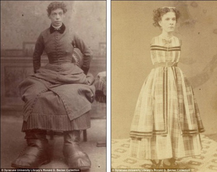 Винтажные фотографии цирковых артистов, на которые больно смотреть - ФОТОСЕССИЯ