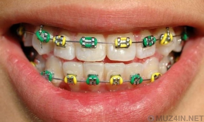 10 невероятно странных фактов о человеческих зубах - ФОТО