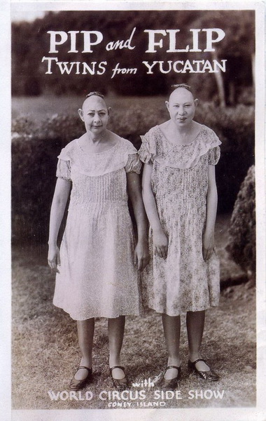 Винтажные фотографии цирковых артистов, на которые больно смотреть - ФОТОСЕССИЯ