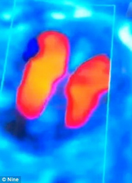 Женщина готовится родить двухголового ребенка - ФОТО