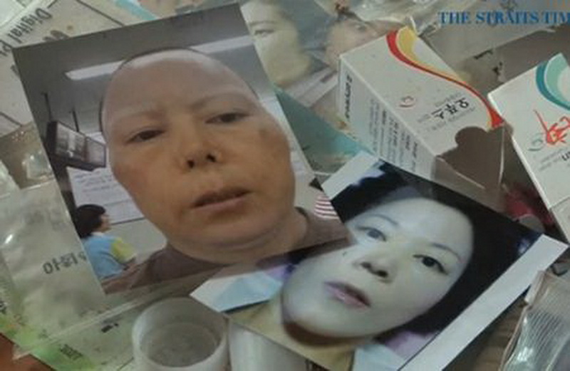 Кореянка превратилась в монстра после 15 операций за день - ФОТО