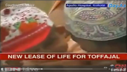 Шок: в Индии родился мальчик с двумя головами - ОБНОВЛЕНО - ВИДЕО - ФОТО