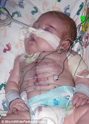 Мальчик, родившийся с половиной сердца на грудине, отметил 3-летие - ФОТО