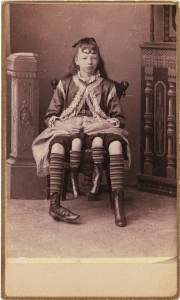 Винтажные фотографии цирковых артистов, на которые больно смотреть - ФОТОСЕССИЯ