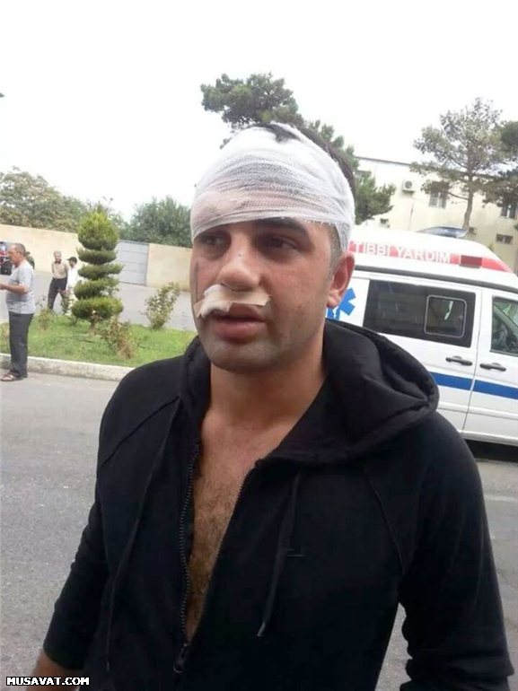"Oazis" davasından yeni şok xəbərlər - FOTO