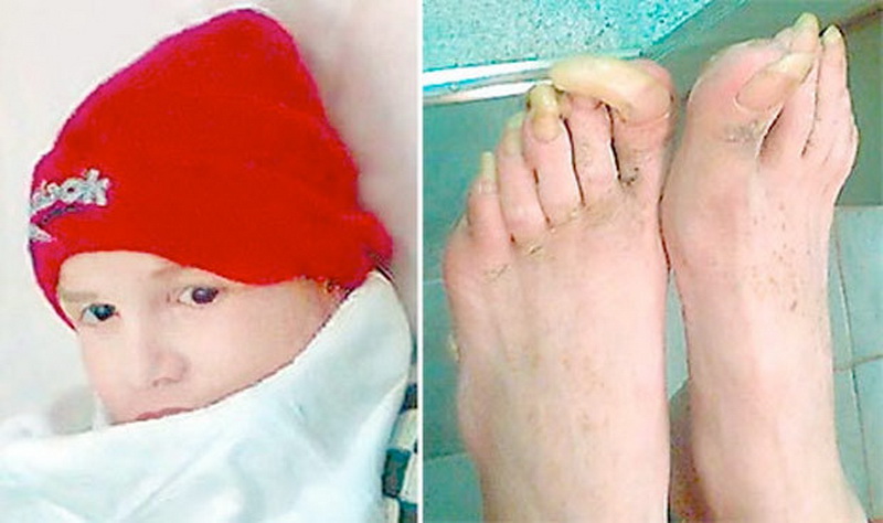 Маугли наших дней: дети, которых вырастили животные - ФОТОСЕССИЯ