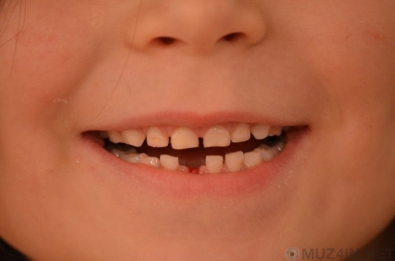 10 невероятно странных фактов о человеческих зубах - ФОТО